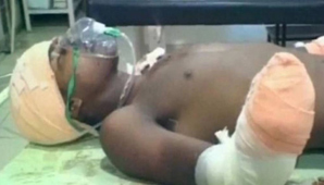 Un hombre le cortó las manos al violador de su beba Un hombre le cortó las manos al violador de su beba