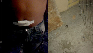 En un confuso episodio, recibió tres puntazos En un confuso episodio, recibió tres puntazos