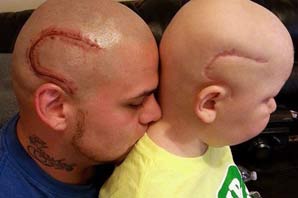 Se tatuó una cicatriz en la cabeza para animar a su hijo enfermo Se tatuó una cicatriz en la cabeza para animar a su hijo enfermo