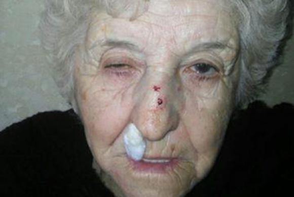 Asalto, polémica y sanción Asalto, polémica y sanción