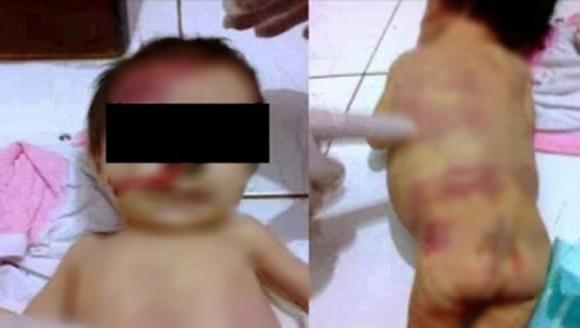 Padres golpearon a su beba hasta dejarla inconsciente Padres golpearon a su beba hasta dejarla inconsciente