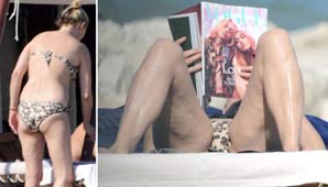 ¿Qué le pasó? ¿Qué le pasó?