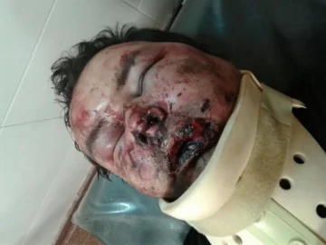 Le molió la cara a golpes por haber chocado su auto Le molió la cara a golpes por haber chocado su auto