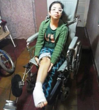 Tiene 13 años, un pitbull se escapó y le arrancó parte del pie derecho Tiene 13 años, un pitbull se escapó y le arrancó parte del pie derecho