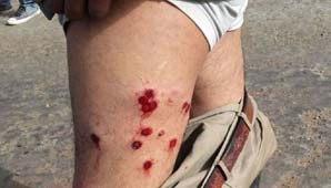 Jujuy: 80 trabajadores del ingenio Ledesma, heridos en una protesta Jujuy: 80 trabajadores del ingenio Ledesma, heridos en una protesta