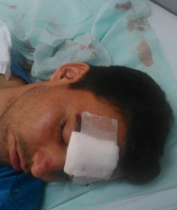 Noquean a golpes a un estudiante para poder robar sus cosas Noquean a golpes a un estudiante para poder robar sus cosas