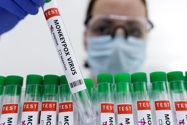 Viruela del mono: dos casos confirmados en Argentina