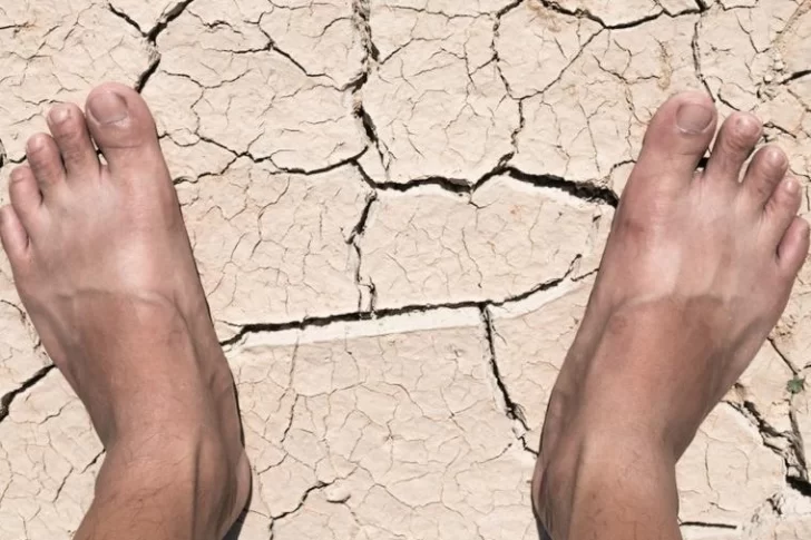 La sequía hace aumentar el riesgo de enfermedades y efectos en piel y pelo