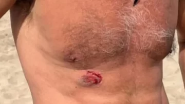 Denunció que fue mordido por un vendedor ambulante y tuvo un final inesperado Denunció que fue mordido por un vendedor ambulante y tuvo un final inesperado