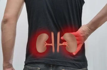 Para 2040, la enfermedad renal puede llegar a ser la 5ta causa de muerte Para 2040, la enfermedad renal puede llegar a ser la 5ta causa de muerte