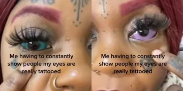 Se tatuó los ojos, sufrió una gravísima inflamación y podría quedarse ciega Se tatuó los ojos, sufrió una gravísima inflamación y podría quedarse ciega