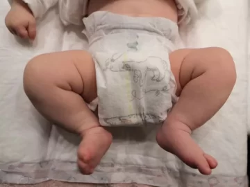 Nacieron las primeras dos bebés concebidas por un robot Nacieron las primeras dos bebés concebidas por un robot