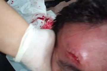 Jugadores y dirigentes de Villa Obrera fueron golpeados y robados en Santa Lucía Jugadores y dirigentes de Villa Obrera fueron golpeados y robados en Santa Lucía