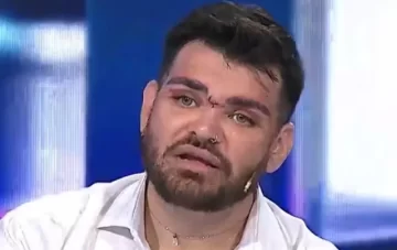 Fran Mariano, internado de urgencia: “Los médicos dijeron que me tienen que amputar el pie” Fran Mariano, internado de urgencia: “Los médicos dijeron que me tienen que amputar el pie”