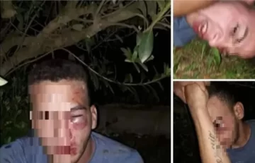 Pactó un encuentro con una chica y la familia de ella lo linchó: “Le pegaron como a un animal”