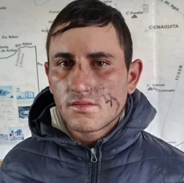 Probation para el sujeto que se lastimó la cara cuando huía en bicicleta de un robo Probation para el sujeto que se lastimó la cara cuando huía en bicicleta de un robo