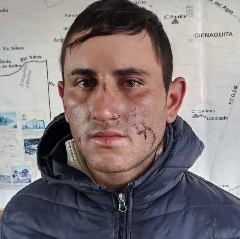 Probation para el sujeto que se lastimó la cara cuando huía en bicicleta de un robo Probation para el sujeto que se lastimó la cara cuando huía en bicicleta de un robo