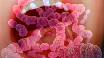 Cuáles son los síntomas de infección invasiva por Streptococcus pyogenes y cómo se trata Cuáles son los síntomas de infección invasiva por Streptococcus pyogenes y cómo se trata