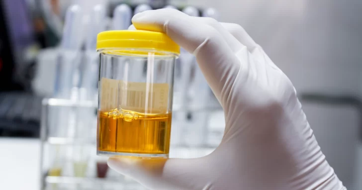 ¡Vigilá el color de tu orina! ¡Vigilá el color de tu orina!