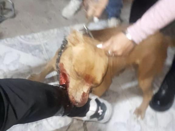 “Le hicieron 92 puntos”: la angustia de la familia de la mujer de 47 años atacada por un pitbull “Le hicieron 92 puntos”: la angustia de la familia de la mujer de 47 años atacada por un pitbull