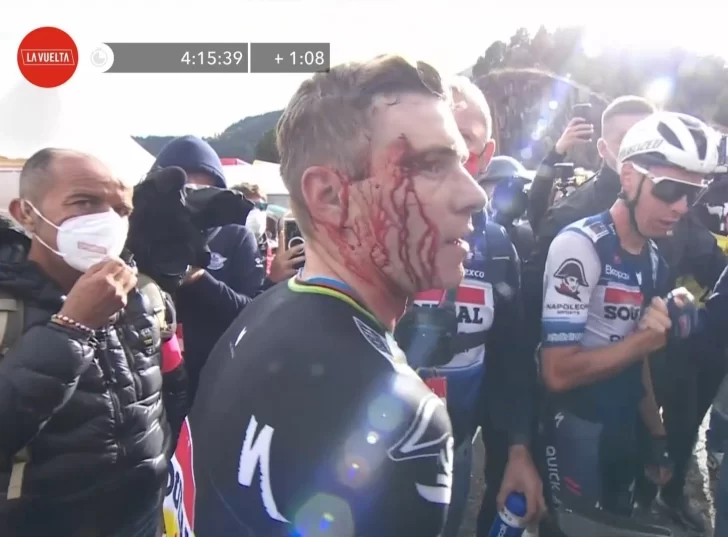 Evenepoel impactó contra una mujer tras cruzar la meta y terminó con el rostro ensangrentado