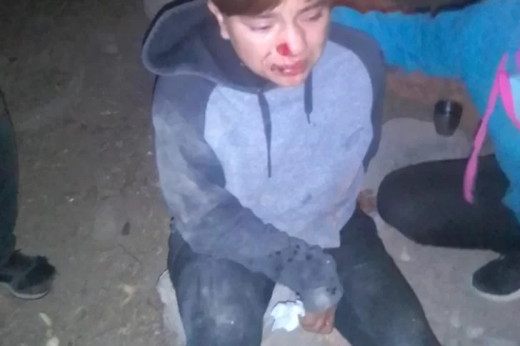 Atropellaron a una futbolista de Atenas cuando iba a comprar y escaparon sin asistirla