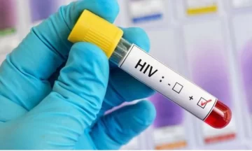 Tres de cada diez diagnósticos de HIV llegan en forma tardía