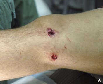 Lo emboscaron, le balearon una pierna y en la Policía creen que fue un ajuste de cuentas