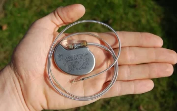 Procesaron a un médico por vender un marcapasos de PAMI a través de Mercado Libre Procesaron a un médico por vender un marcapasos de PAMI a través de Mercado Libre