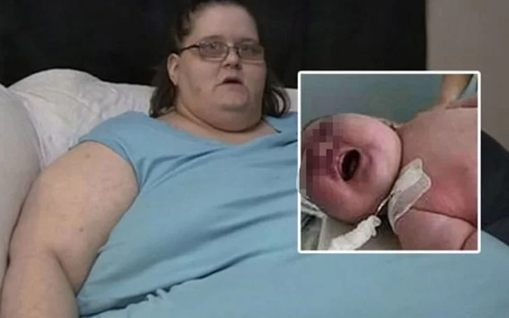 Un bebé recién nacido rompió un récord mundial al pesar 18 kilos Un bebé recién nacido rompió un récord mundial al pesar 18 kilos