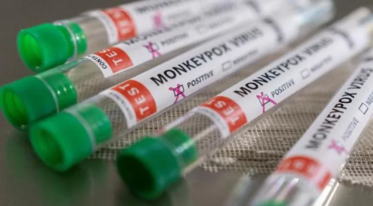 Confirmaron el primer caso de viruela del mono en Argentina