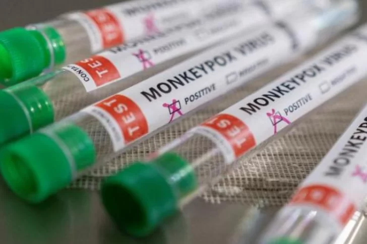 Confirmaron el primer caso de viruela del mono en Argentina