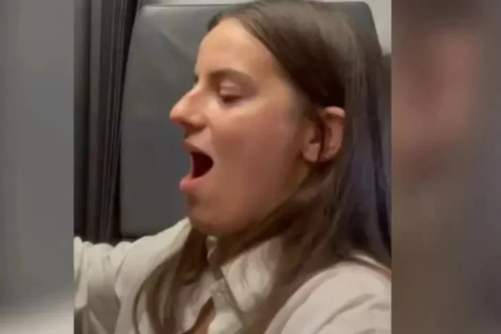 Dramático momento con un pasajera que bostezó y se le salió de lugar la mandíbula Dramático momento con un pasajera que bostezó y se le salió de lugar la mandíbula