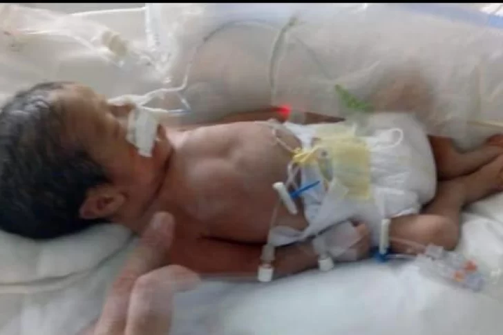 Un bebé estuvo al borde de la muerte y ahora necesita ayuda para ir su hogar
