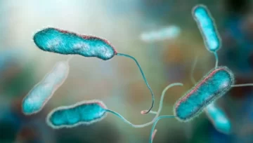 Legionella: todo lo que hay que saber de la bacteria que causó el brote en Tucumán Legionella: todo lo que hay que saber de la bacteria que causó el brote en Tucumán