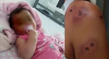 Una beba recibió un balazo de goma en la cabeza durante un procedimiento policial Una beba recibió un balazo de goma en la cabeza durante un procedimiento policial