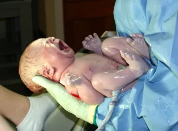 ¿Qué le pasa al cuerpo del bebé durante el parto? ¿Qué le pasa al cuerpo del bebé durante el parto?