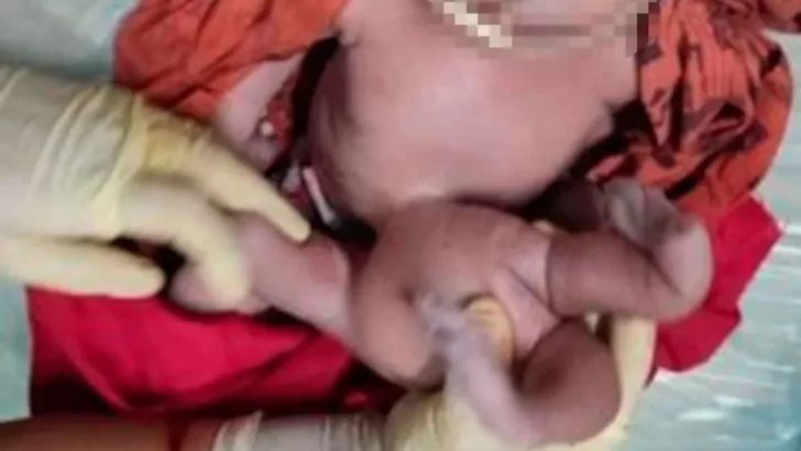 Nació un bebé con cuatro brazos y cuatro piernas: creen que es “reencarnación de Dios” Nació un bebé con cuatro brazos y cuatro piernas: creen que es “reencarnación de Dios”