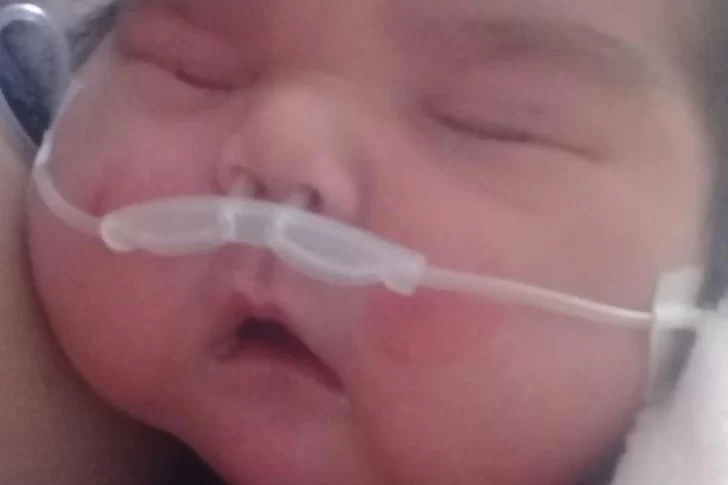 Mejora el estado de salud de Maicol, el “súper bebé” que nació con 5,650 Kg