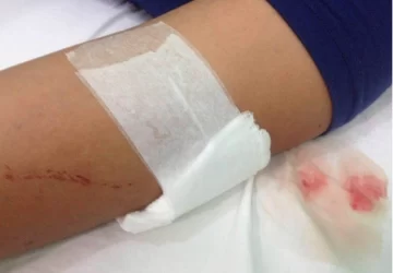 Balearon a una joven para robarle Balearon a una joven para robarle