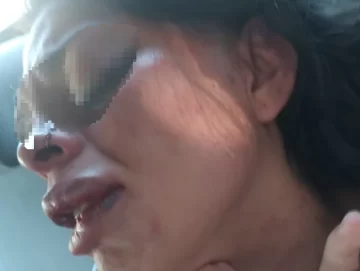Mujer atacada por su ex con un destornillador: “Me dijo que me despidiera de mis hijas” Mujer atacada por su ex con un destornillador: “Me dijo que me despidiera de mis hijas”
