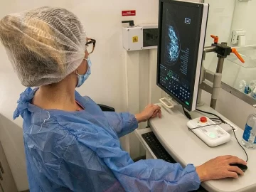 Más del 70% de las mujeres con cáncer de mama no tienen antecedentes familiares