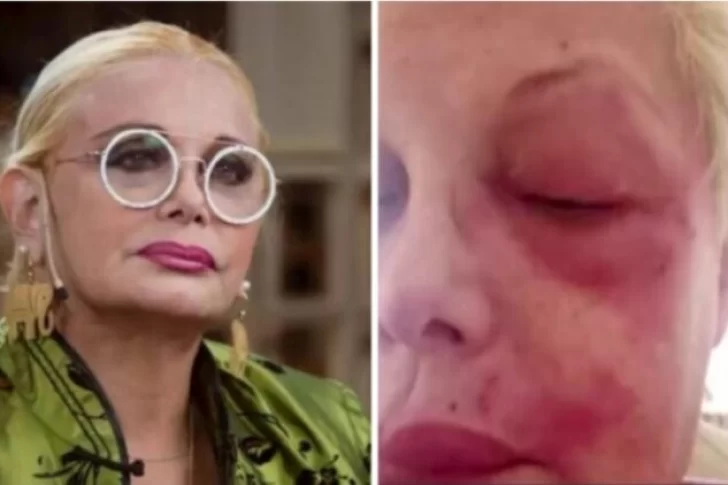 La angustia de Carmen Barbieri por tener Covid-19 nuevamente