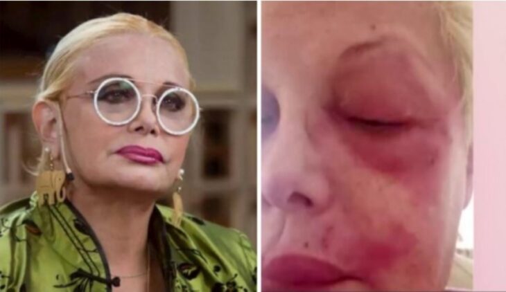 La angustia de Carmen Barbieri por tener Covid-19 nuevamente La angustia de Carmen Barbieri por tener Covid-19 nuevamente