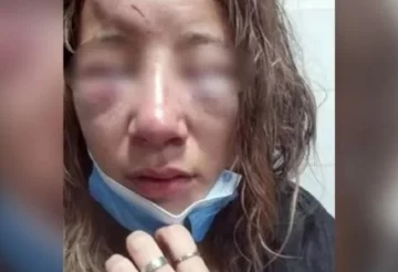 Desfiguraron a una chica a la salida de un boliche y le arrancaron las uñas