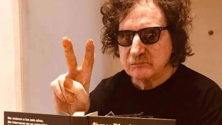 Charly García recibió el alta y seguirá su recuperación en su casa Charly García recibió el alta y seguirá su recuperación en su casa