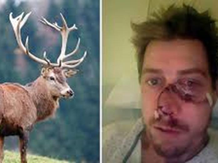 Un ciervo le arrancó la mitad de la cara a un cazador Un ciervo le arrancó la mitad de la cara a un cazador