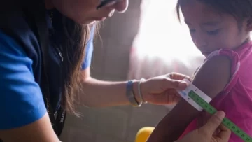 Distribuyen en Argentina innovadora cinta que permite medir malnutrición en niños