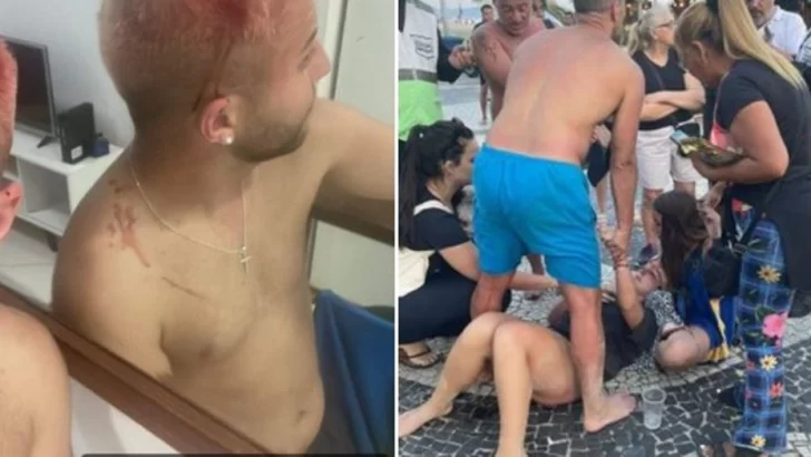 Barras de Fluminense atacaron e hirieron a hinchas de Boca en Copacabana Barras de Fluminense atacaron e hirieron a hinchas de Boca en Copacabana