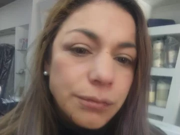 Dentro de su local, una mujer recibió una paliza por parte de familiares que no veía hace 15 años Dentro de su local, una mujer recibió una paliza por parte de familiares que no veía hace 15 años